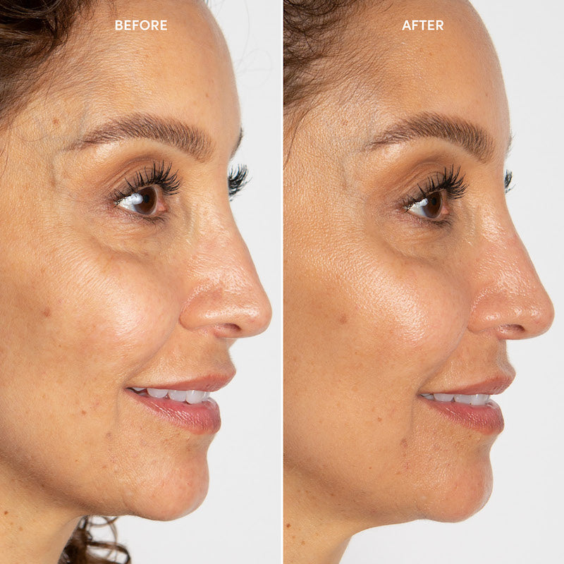 Contouring & Lifting DUO